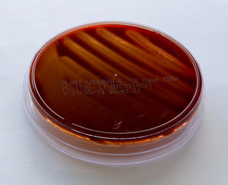 Placa Ágar Sangue/ Ágar Chocolate com Vitox 2 90MM Plastlabor