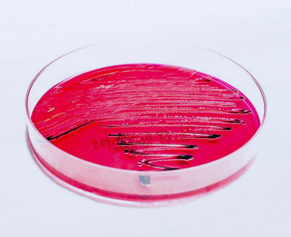 Xld Agar Shigella